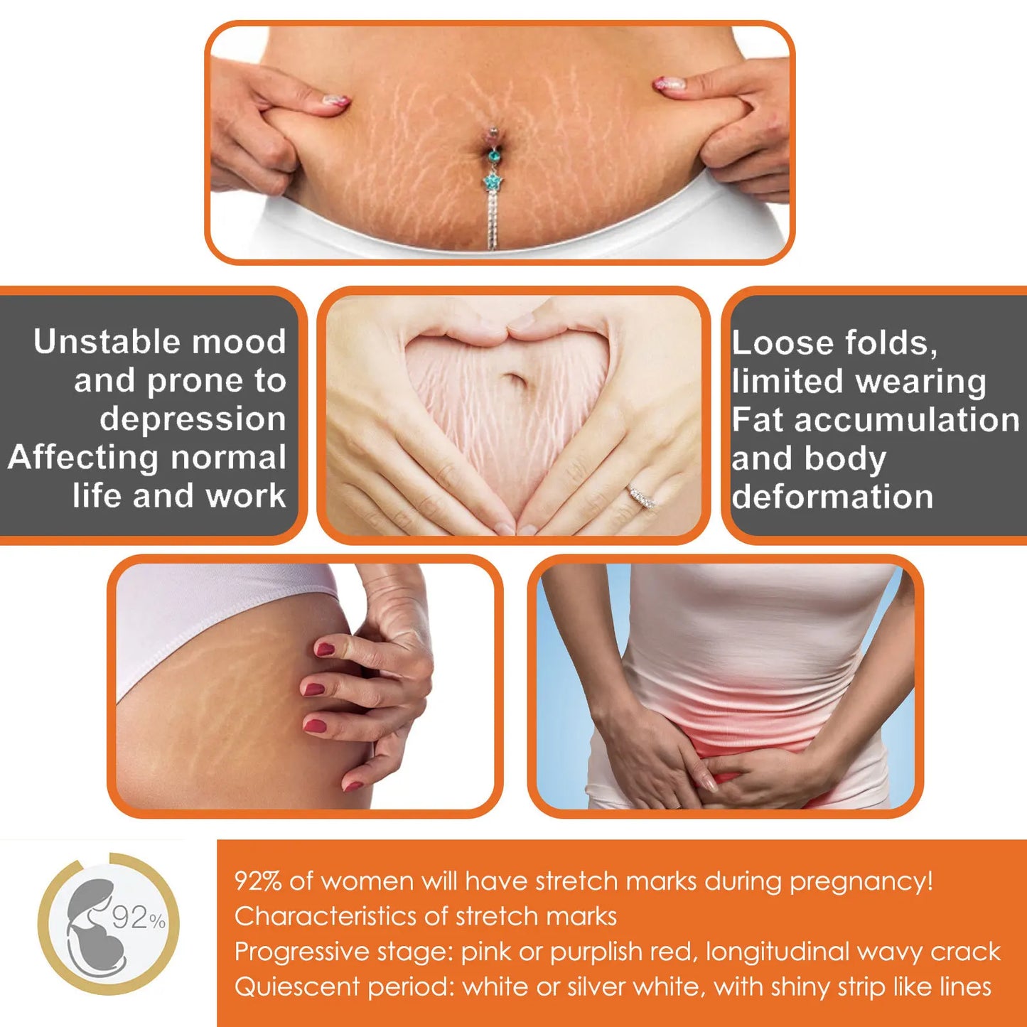 Pregnancy Mark Remove Cream Effective Repair Maternity Stretch Mark Scars Acne Smooth Skin Firming Body Cream Skin Care Products